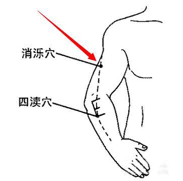 消爍穴|【消爍穴】消濼準確位置和作用 